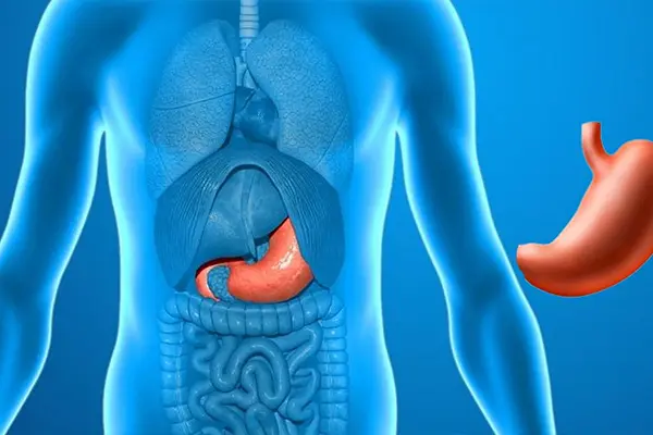 Ayarlanabilir Gastrik Band Nedir?
