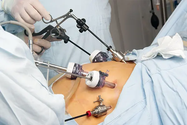 Gastrik Bypass Nasıl Çalışır?